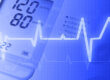EKG