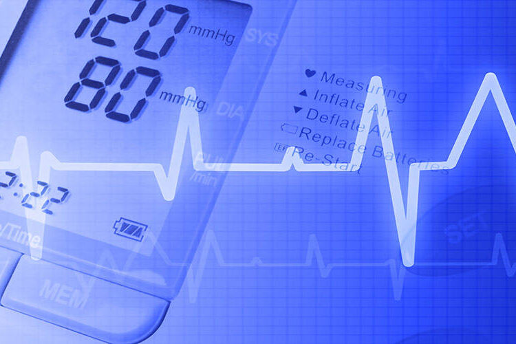 EKG