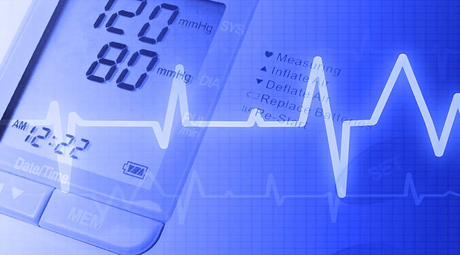 EKG