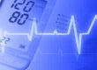 EKG