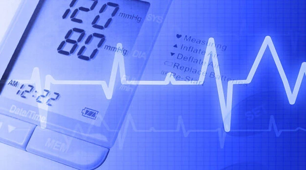 EKG