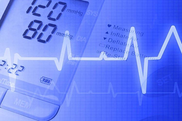 EKG