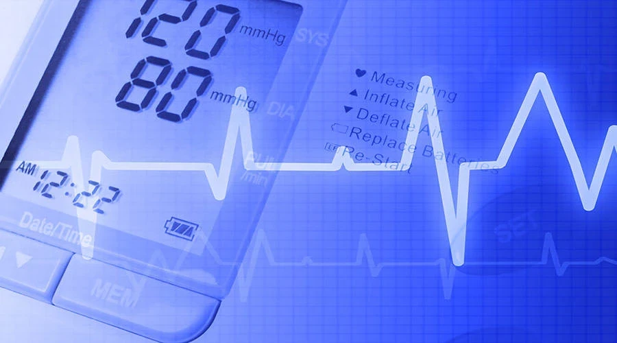 EKG